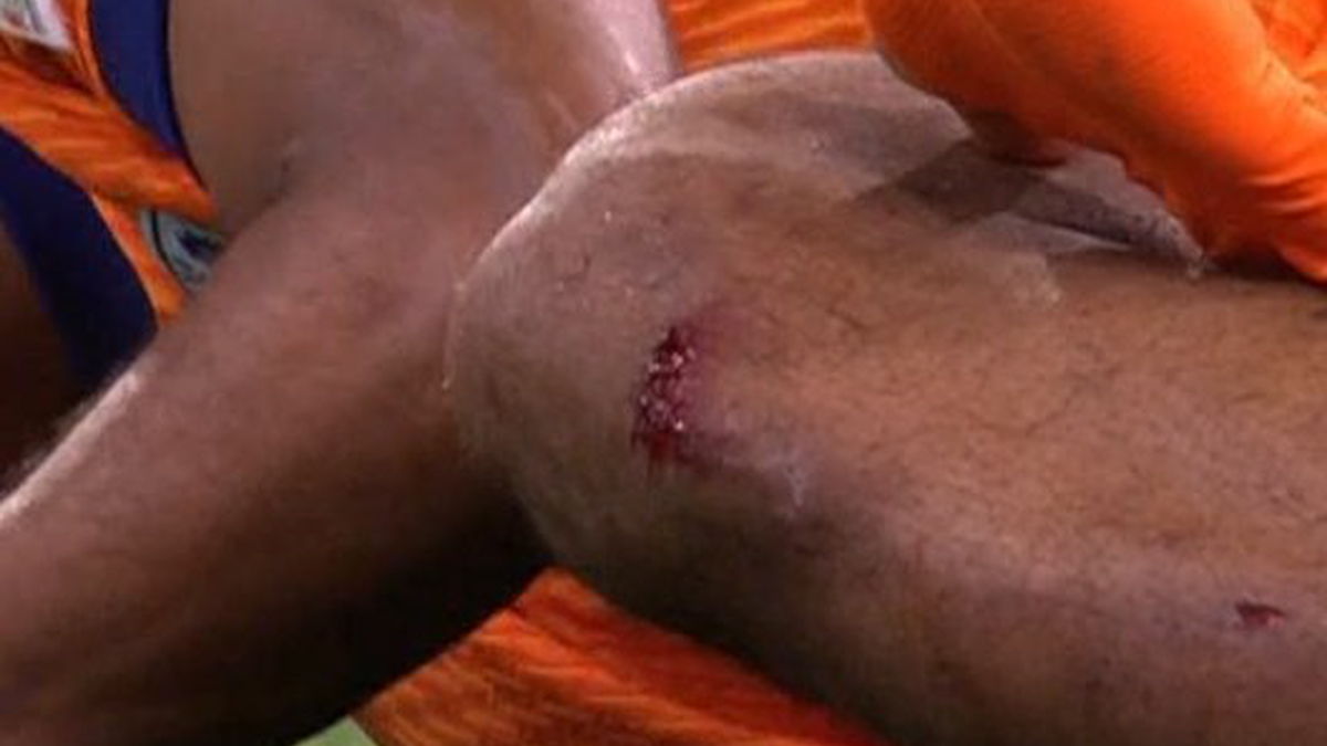 Wat je op TV niet zag: horrortackle op Timber blijft onbestraft